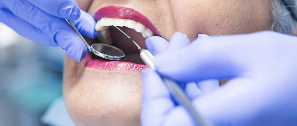 Best Emergency Root Canal Treatment in Osawatomie, KS